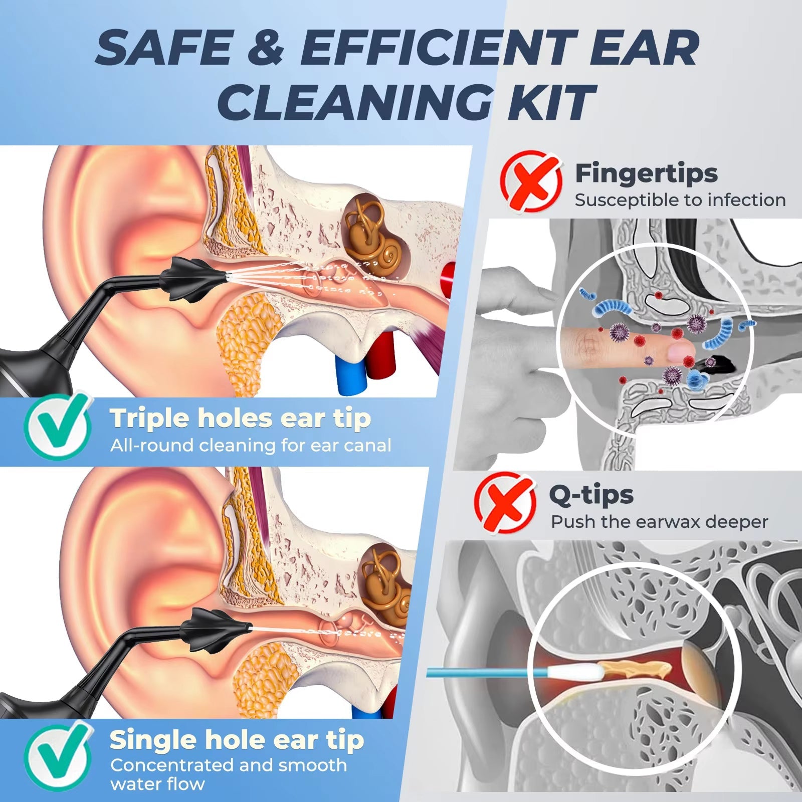 EarmBlis v2