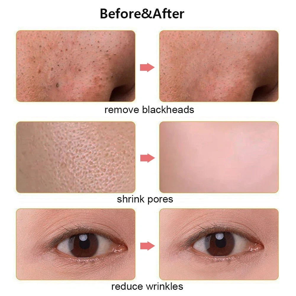 SkinSonyc