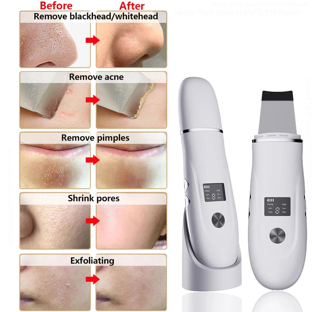 SkinSonyc